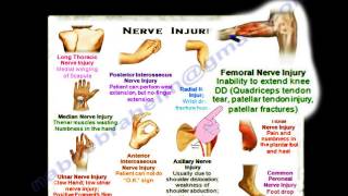 Nerve Injuries Summary Thank You Card  Everything You Need To Know  Dr Nabil Ebraheim [upl. by Monjan227]