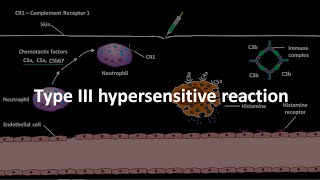 Hypersensitive reaction type 3 [upl. by Deraj]