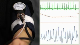 Oscillometric blood pressure measurement [upl. by Asirram]