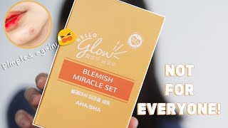 ACNE BREAKOUTS using Hello Glow Blemish Miracle Set [upl. by Eentrok353]