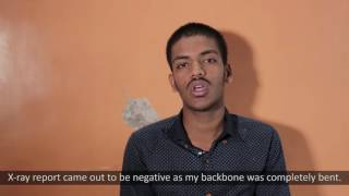 Adalimumab  Ankylosing Spondylitis  Testimonial  Mumbai [upl. by Viens]