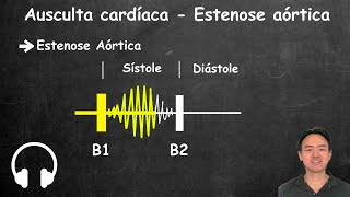 Ausculta cardiaca estenose aortica e insuficiencia aortica [upl. by Steffen702]