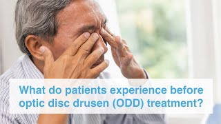 What do patients experience before optic disc drusen ODD treatment [upl. by Gilford]