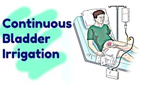 Continuous Bladder Irrigation  RN Krizzy [upl. by Eyssej]