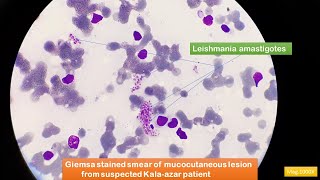 Leishmania amastigotes Microscopy [upl. by Eedia135]