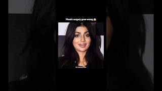 Celebrities plastic surgery has gone wrong but not aditys 😍😱 shortsfeed shorts viral trending [upl. by Ijies]