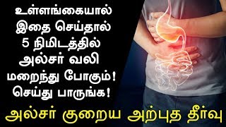 அல்சர் குணமாக வீட்டு வைத்தியம்  Ulcer Treatment in Tamil Ulcer Symptoms in Tamil Tamil Health Tips [upl. by Seidnac]