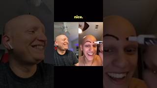 I GET EYEBROWS comedy funny lol alopecia bald mcsquared90 [upl. by Strohl]