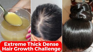 30 Days Extreme Thick Hair Growth ChallengeIncrease Hair Density amp thicknessपतले बालों को घना करे [upl. by Eleets]