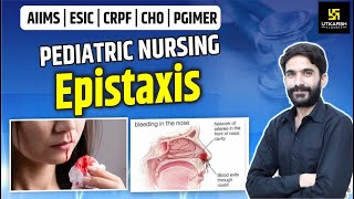 AIIMS  ESIC  CRPF  PGIMER  Epistaxis  Pediatric Nursing  By Raju Sir [upl. by Athalie]