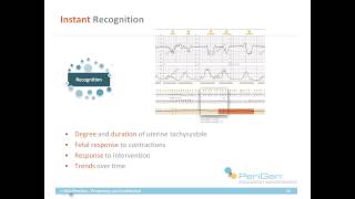 PeriGen Presents  Uterine Tachysystole How much is really too much [upl. by Airdnola441]