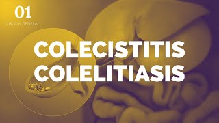 Colecistitis y Colelitiasis  ENARM [upl. by Esidnak408]