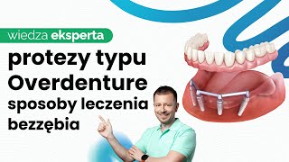 PROTEZA OVERDENTURE NA IMPLANTACH  ODBUDOWA NAJCZEŚCIEJ WYBIERANA PRZEZ PACJENTÓW [upl. by Annawyt]