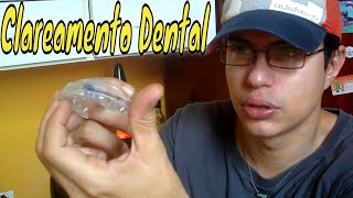 Clareamento Dental Com Moldeiras Whitness Perfect [upl. by Tedi26]