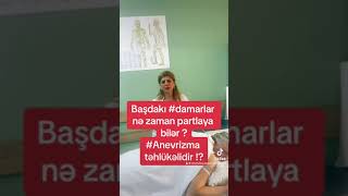 Başdakı damarlar nə zaman partlaya bilər ⁉️Anevrizma təhlükəlidir ⁉️ kesfet beyinqandovrani [upl. by Veronike]