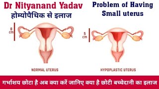 Treatment of Hypoplastic uterus with homoeopathic medicine with documentary proof [upl. by Preuss505]