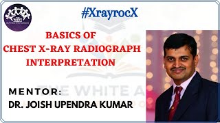 BASICS OF CHEST XRAY RADIOGRAPH INTERPRETATION [upl. by Campball]