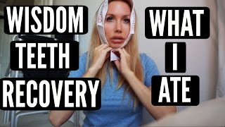 WISDOM TEETH RECOVERY  WHAT I ATE [upl. by Keenan478]