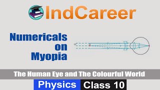 Difference in Myopia and Hyperopia  Nearsighted and FarSighted Lens  Class 10  Letstute CBSE [upl. by Lyred]