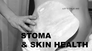 Stoma and Skin Health [upl. by Gnurt]