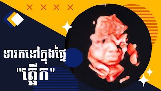 ទារកនៅក្នុងផ្ទៃ quotត្អើកquot  Baby hiccups in the womb [upl. by Ahsied]