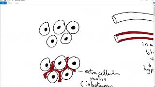 GENERAL PATHOLOGY 5  amyloidosis  structure  pathogenesis classification DR SAMEH GHAZY [upl. by Akcimahs]