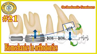 21 Biomechanics in orthodontics سيمينارات تقويم الأسنان جامعة الأزهر [upl. by Asssilem798]