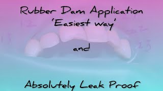 Rubber dam application in exact one and a half minutes [upl. by Ariec]