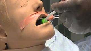 Mouth Care on Intubated Patients [upl. by Liagaba]