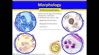 Echinococcus granulosus and Echinococcus multilocularis Cestodes [upl. by Moriyama]