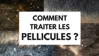 COMMENT TRAITER LES PELLICULES [upl. by Robert]