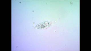 Инфузория туфелька умирает под микроскопом under microscope [upl. by Okorih814]