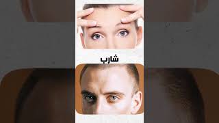 اوعي تحلق المناطق دي بالموس skincareroutine chad workout تحفيز معلومات glowing تطويرالذات [upl. by Brew]