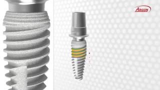 Argon Rapid amp Sure Implant Features amp Benefits Video [upl. by Aehcsrop]