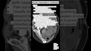 Acute mesenteric ischemia [upl. by Valdes583]