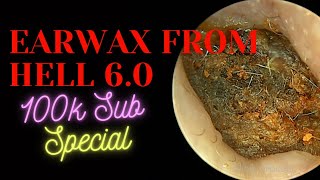 Earwax From Hell 60 100k Sub Special [upl. by Shuping]