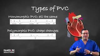 One Quick Question What are PVCs Premature Ventricular Contractions [upl. by Neetsirk]