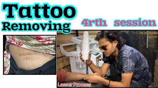 How to Remove tattoos  4rth session tattoos removal process tattoo removal tutorial stepbystep [upl. by Llenad867]