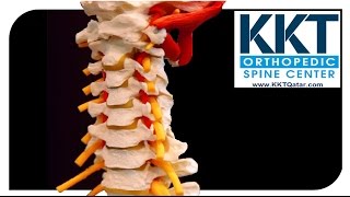 KKT Qatar Non invasive treatment for back pain and spine care [upl. by Sucramed]