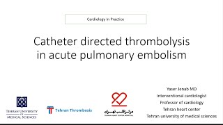 Catheter directed thrombolysis CDT in acute pulmonary embolism [upl. by Atinot]