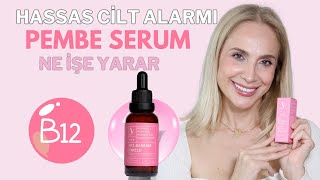 Hassas Ciltler İçin Pembe Serum Ne İşe Yarar [upl. by Ayote]