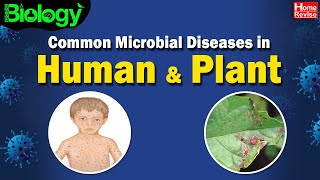 Common Microbial Diseases in Humans amp Plants  Biology  Home Revise [upl. by Esaele123]