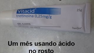 Como estou usando ácido tretinoína  Vitacid 1 [upl. by Maddy]