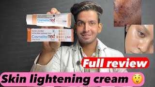 Cosmelite cream  Cosmelite cream ke fayde aur nuksan  Cosmelite cream review  cosmelite use [upl. by Oika]