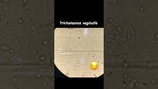 Trichomonas 🧫 Parasitologia [upl. by Ayhay]