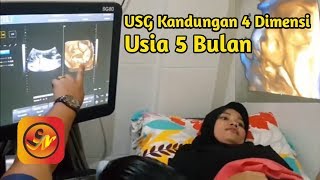 USG Kandungan 4D Usia 5 bulan [upl. by Latsyrc971]