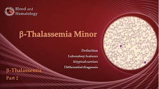 BetaThalassemia part 2  BetaThalassemia Minor [upl. by Lyret]