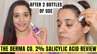 The Derma Co 2 Salicylic Acid Serum Review After 2 Bottles Of Use  Best Serum For Pimples [upl. by Artinek]