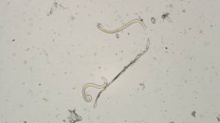 Parelaphostrongylus tenuis2 microscopic view [upl. by Nelav104]