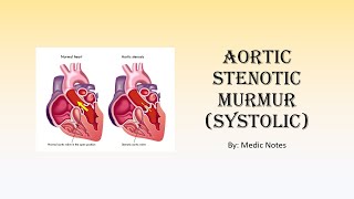 Aortic stenotic murmur  definition causes pathophysiology mechanism of dynamic maneuvers [upl. by Eirol]